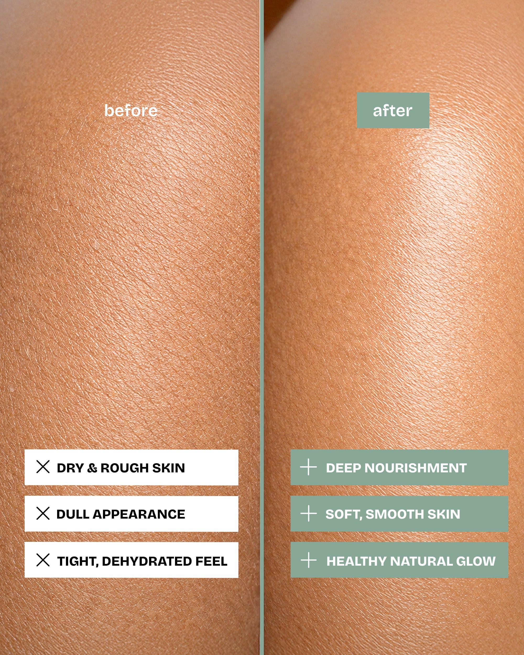 The Zero Irritant Body Kit(Purifying Soap Bar, Body Butter, Natural Deodrant)