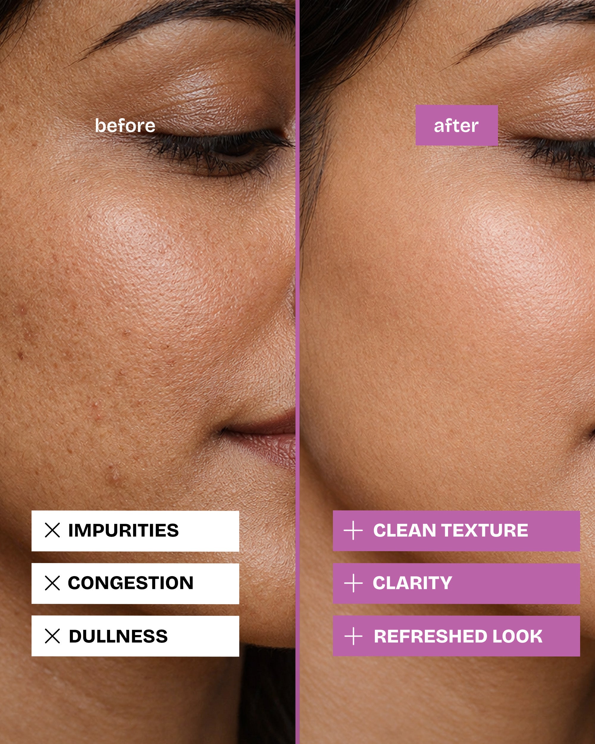 The Zero Irritant Body Kit(Purifying Soap Bar, Body Butter, Natural Deodrant)